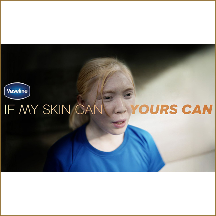 If My Skin Can, Yours Can